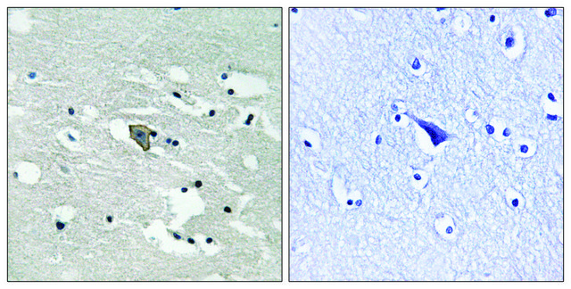 Anti-phospho-VEGFR1 (pTyr1048) antibody produced in rabbit affinity isolated antibody