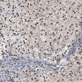 Anti-FOXN2 antibody produced in rabbit Prestige Antibodies® Powered by Atlas Antibodies, affinity isolated antibody, buffered aqueous glycerol solution