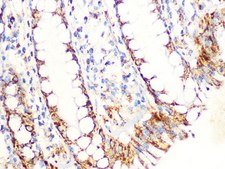 Anti-Aconitase 2 (ACO2) antibody produced in rabbit