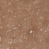 抗-THY1 兔抗 Prestige Antibodies® Powered by Atlas Antibodies, affinity isolated antibody, buffered aqueous glycerol solution