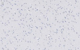 Anti-Amyloid β42/40 Antibody, clone W0-2 ZooMAb® Mouse Monoclonal recombinant, expressed in HEK 293 cells