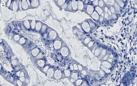 Anti-Integrin β4 Antibody, clone 3D11 ZooMAb® Rabbit Monoclonal recombinant, expressed in HEK 293 cells