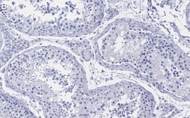 Anti-KLF5 Antibody, clone 1J12 ZooMAb® Rabbit Monoclonal recombinant, expressed in HEK 293 cells