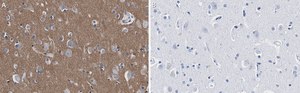 Anti-CD56 Antibody, clone 3F5 ZooMAb® Rabbit Monoclonal recombinant, expressed in HEK 293 cells