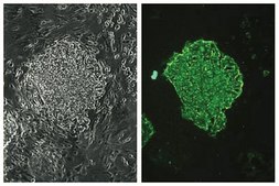 抗-阶段特异性胚胎抗原-4抗体，克隆MC-813-70 clone MC-813-70, Chemicon®, from mouse