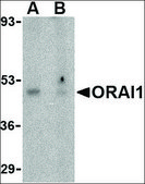 Anti-ORAI1 antibody produced in rabbit affinity isolated antibody, buffered aqueous solution