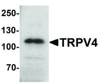 Anti-TRPV4 antibody produced in rabbit affinity isolated antibody