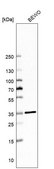 Anti-MARC1 antibody produced in rabbit Prestige Antibodies® Powered by Atlas Antibodies, affinity isolated antibody, buffered aqueous glycerol solution