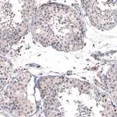 Anti-FOXM1 antibody produced in rabbit Prestige Antibodies® Powered by Atlas Antibodies, affinity isolated antibody, buffered aqueous glycerol solution