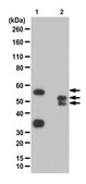 Anti-p40 Antibody from rabbit, purified by affinity chromatography