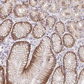 Anti-SLC9A1 antibody produced in rabbit Prestige Antibodies® Powered by Atlas Antibodies, affinity isolated antibody, buffered aqueous glycerol solution