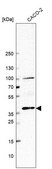 Anti-BMP2 antibody produced in rabbit Prestige Antibodies® Powered by Atlas Antibodies, affinity isolated antibody