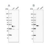 Anti-BHMT antibody produced in rabbit Prestige Antibodies® Powered by Atlas Antibodies, affinity isolated antibody, buffered aqueous glycerol solution