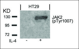 抗-磷酸化-JAK2 (pTyr1007) 兔抗 affinity isolated antibody