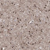 Anti-APAF1 antibody produced in rabbit Prestige Antibodies® Powered by Atlas Antibodies, affinity isolated antibody, buffered aqueous glycerol solution