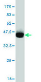 Monoclonal Anti-ABCC4 antibody produced in mouse clone 1B2, purified immunoglobulin, buffered aqueous solution