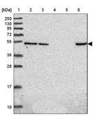 Anti-HDAC3 antibody produced in rabbit Prestige Antibodies® Powered by Atlas Antibodies, affinity isolated antibody, buffered aqueous glycerol solution