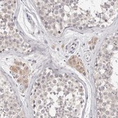Anti-DOPEY1 antibody produced in rabbit Prestige Antibodies® Powered by Atlas Antibodies, affinity isolated antibody, buffered aqueous glycerol solution, ab1