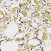 Anti-TGFBR2 antibody produced in rabbit