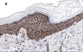 Anti-phos-AMPKα (Thr172) Antibody, clone 5J23 , ZooMAb® Rabbit Monoclonal recombinant, expressed in HEK 293 cells
