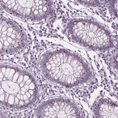 Anti-CDKN1C antibody produced in rabbit Prestige Antibodies® Powered by Atlas Antibodies, affinity isolated antibody, buffered aqueous glycerol solution