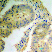 Anti-phospho-Smad1 (pSer465) antibody produced in rabbit affinity isolated antibody