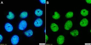 Anti-BRG1/SMARCA4 Antibody, clone 20C3.2 ZooMAb® Mouse Monoclonal recombinant, expressed in HEK 293 cells