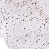 Monoclonal Anti-Smarcb1 Antibody Produced In Mouse Prestige Antibodies® Powered by Atlas Antibodies, clone CL14031, affinity isolated antibody, buffered aqueous glycerol solution