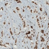 Monoclonal Anti-ERCC1 antibody produced in mouse Prestige Antibodies® Powered by Atlas Antibodies, clone CL1249, purified immunoglobulin, buffered aqueous glycerol solution