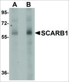 Anti-SCARB1 antibody produced in rabbit affinity isolated antibody, buffered aqueous solution