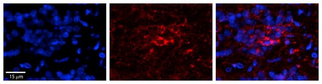 Anti-SGK1 antibody produced in rabbit affinity isolated antibody