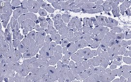 Anti-RHOT1/MIRO-1 Antibody, clone 1F4 ZooMAb® Rabbit Monoclonal recombinant, expressed in HEK 293 cells