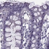 Anti-CALCR antibody produced in rabbit Prestige Antibodies® Powered by Atlas Antibodies, affinity isolated antibody