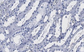 Anti-PLCγ1 Antibody, clone 1H21 ZooMAb® Rabbit Monoclonal recombinant, expressed in HEK 293 cells