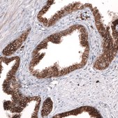Monoclonal Anti-Adam10 Antibody Produced In Mouse Prestige Antibodies® Powered by Atlas Antibodies, clone CL13808, affinity isolated antibody, buffered aqueous glycerol solution