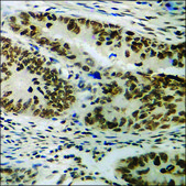 Anti-phospho-JAK2 (pTyr1007) antibody produced in rabbit affinity isolated antibody