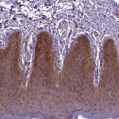 Anti-IRF6 antibody produced in rabbit Prestige Antibodies® Powered by Atlas Antibodies, affinity isolated antibody, buffered aqueous glycerol solution