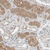 Anti-IL1RL1 antibody produced in rabbit Ab2, Prestige Antibodies® Powered by Atlas Antibodies, affinity isolated antibody, buffered aqueous glycerol solution