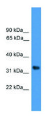 Anti-WDR5 (C-terminal) antibody produced in rabbit affinity isolated antibody
