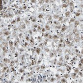 Anti-BNIP3L antibody produced in rabbit Prestige Antibodies® Powered by Atlas Antibodies, affinity isolated antibody, buffered aqueous glycerol solution