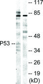 Anti-p53 antibody produced in rabbit affinity isolated antibody
