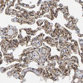 Anti-MYO1C antibody produced in rabbit Prestige Antibodies® Powered by Atlas Antibodies, affinity isolated antibody, buffered aqueous glycerol solution