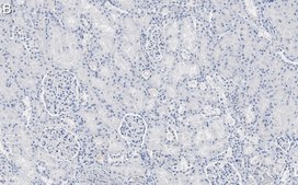 Anti-Nestin Antibody, clone 10C2 ZooMAb® Mouse Monoclonal recombinant, expressed in HEK 293 cells