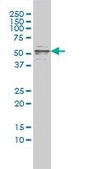 Monoclonal Anti-CFLAR antibody produced in mouse clone 2F12, purified immunoglobulin, buffered aqueous solution