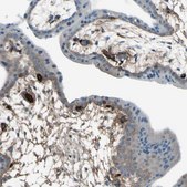 Anti-AFP antibody produced in rabbit Prestige Antibodies® Powered by Atlas Antibodies, affinity isolated antibody, buffered aqueous glycerol solution