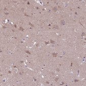 Anti-RASD1 antibody produced in rabbit Prestige Antibodies® Powered by Atlas Antibodies, affinity isolated antibody, buffered aqueous glycerol solution