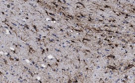 Anti-GFAP Antibody, clone 2E8, ZooMAb® Rabbit Monoclonal recombinant, expressed in HEK 293 cells