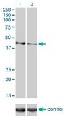 Monoclonal Anti-CALR3 antibody produced in mouse clone 4E3, purified immunoglobulin, buffered aqueous solution