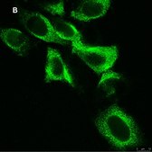 Anti-EGFR Antibody, clone 11E19, ZooMAb® Rabbit Monoclonal recombinant, expressed in HEK 293 cells