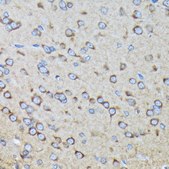 Anti-RALBP1 Antibody, clone 5C10W9, Rabbit Monoclonal